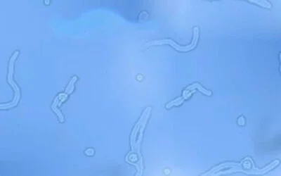 ¿Qué son las Moscas Volantes?